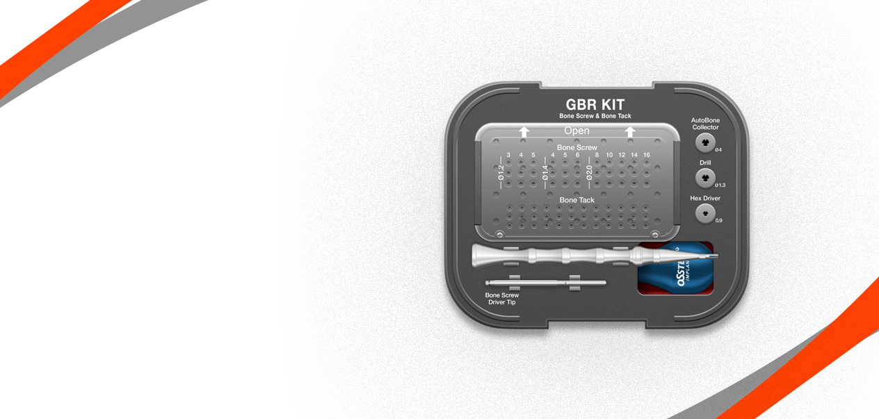 GBR Kit